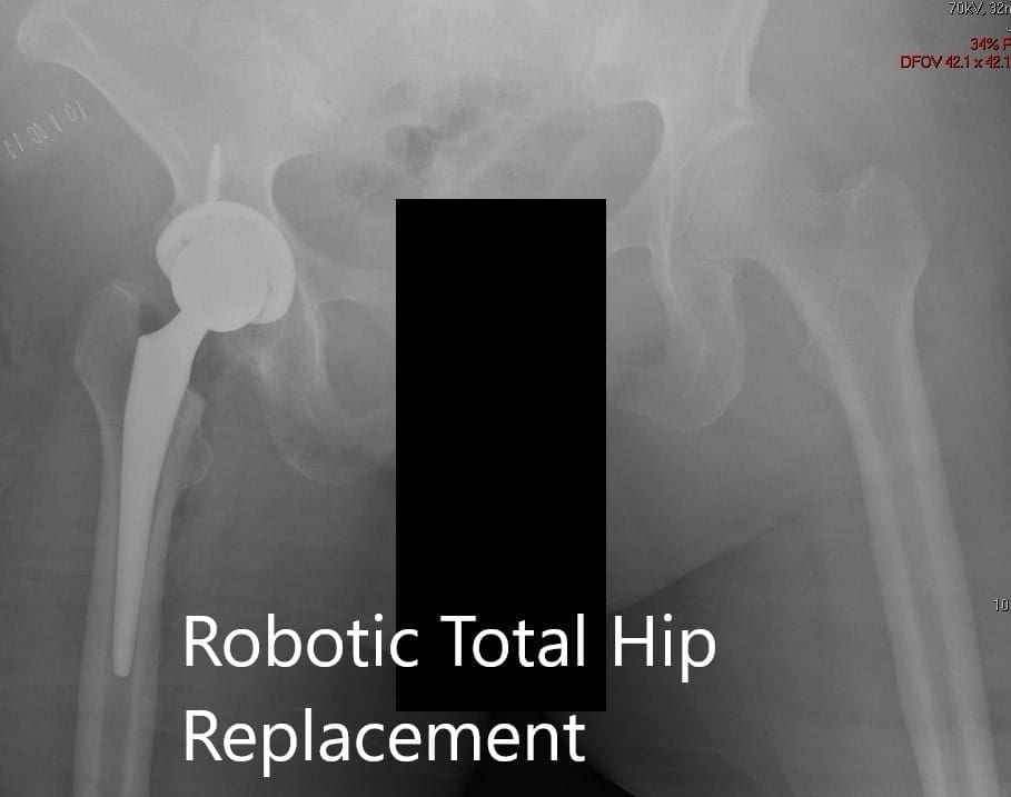Imágenes postoperatorias que muestran las imágenes AP y laterales.