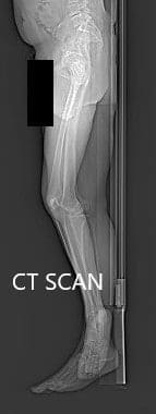 Preoperative CT scan topography images - img 2 Preoperative CT scan topography images - img 2