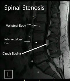 Resonancia magnética que muestra secciones sagital y axial Resonancia magnética que muestra secciones sagital y axial