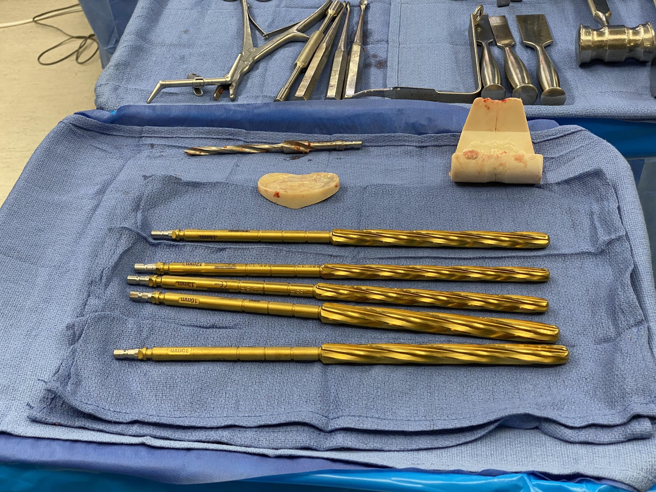 Removed articulating cement spacer and reamers Removed articulating cement spacer and reamers