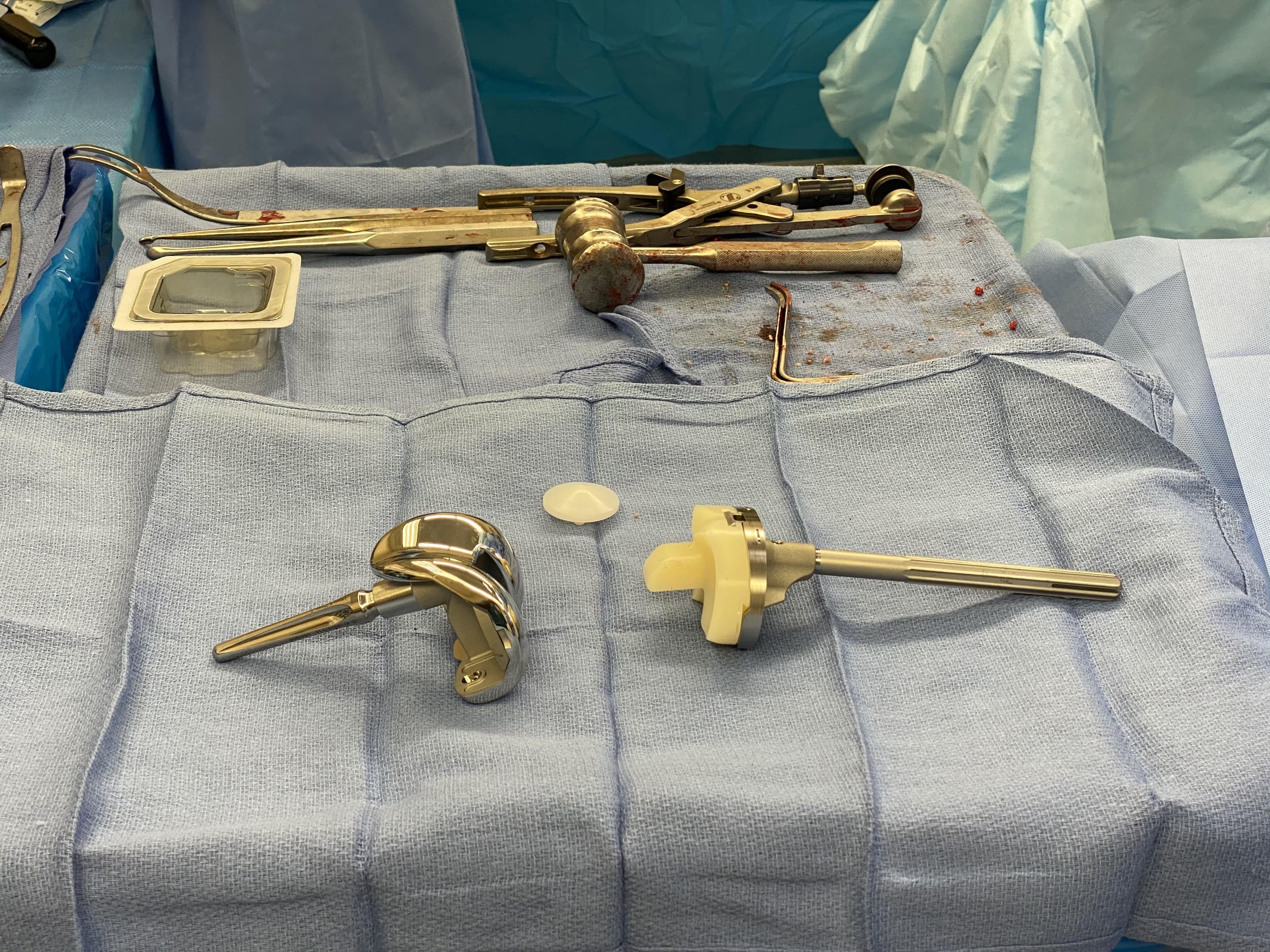 Revision knee replacement implant (semi - constrained with a long stem) Revision knee replacement implant (semi - constrained with a long stem)