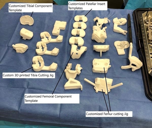 Plantillas personalizadas de prótesis de rodilla y