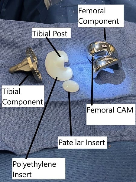 Knee replaceemnt parts
