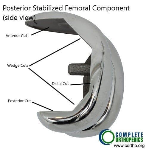 Componente femoral (vista lateral)