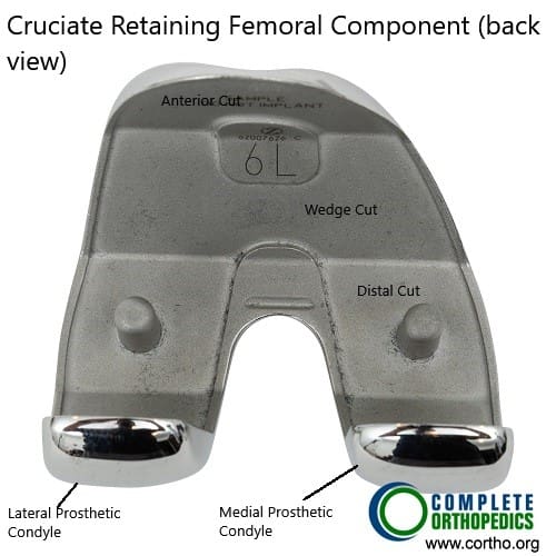 Componente femoral retenedor cruzado