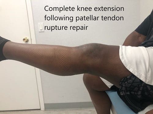 Imágenes postoperatorias a los 2 meses de seguimiento.