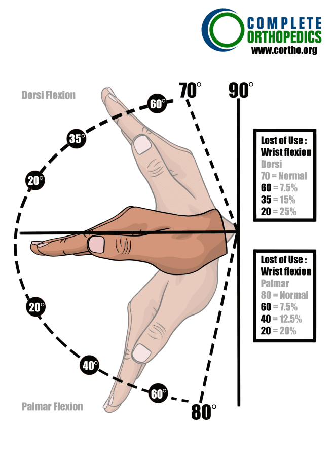 Flexión dorsal y flexión de palmar de la muñeca para evaluar la pérdida de movimiento y calcular la pérdida programada de uso para un paciente de compensación laboral