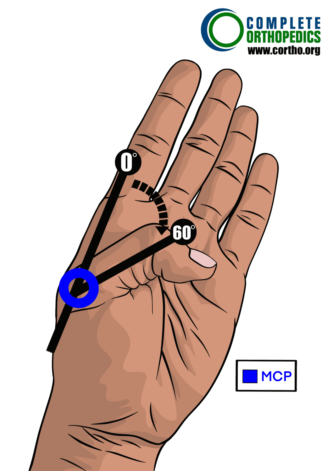 metacarpophalangeal joint of thumb to evaluate loss of motion to calculate scheduled loss of use for workers compensation patient