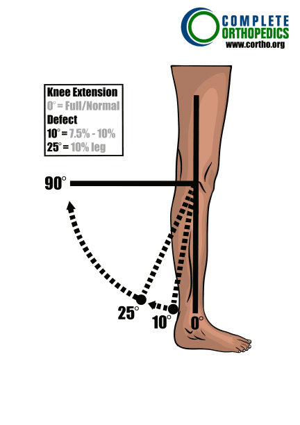 Extensión de rodilla para evaluar la pérdida de movimiento y calcular la pérdida de uso programada para pacientes de compensación laboral