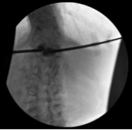 Imagen fluoroscópica