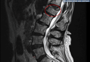 Radiografía preoperatoria