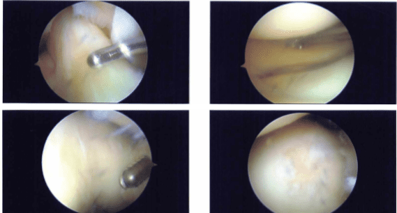 Imágenes intraoperatorias