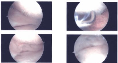 Imágenes intraoperatorias