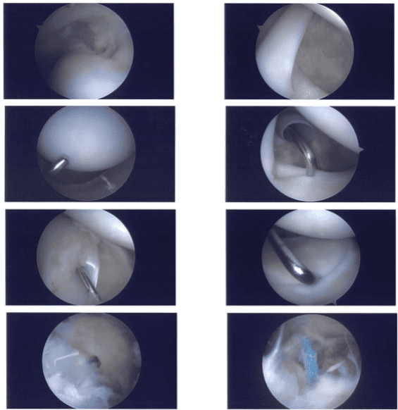 Imágenes intraoperatorias