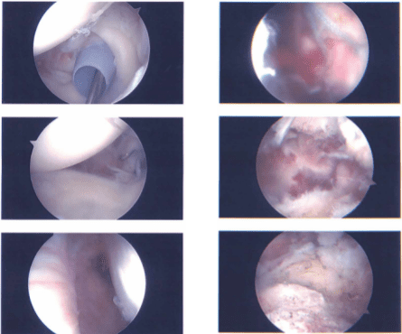 Intraoperative report