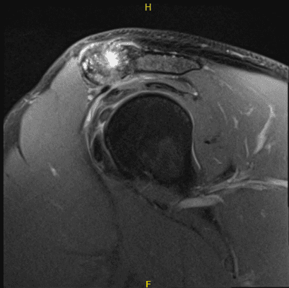Intraoperative Arthroscopy Images