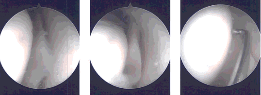 Imágenes intraoperatorias