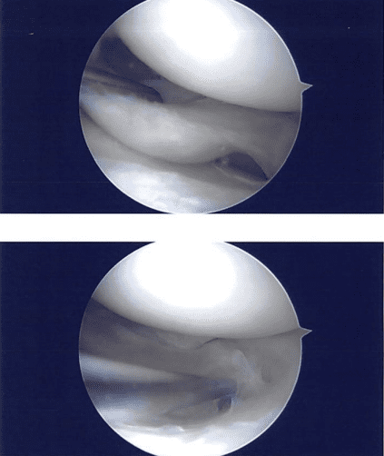 Imágenes intraoperatorias