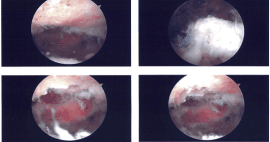 Imágenes intraoperatorias