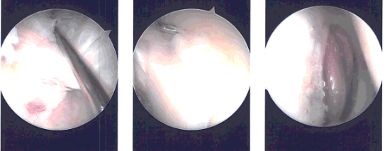 Imágenes intraoperatorias