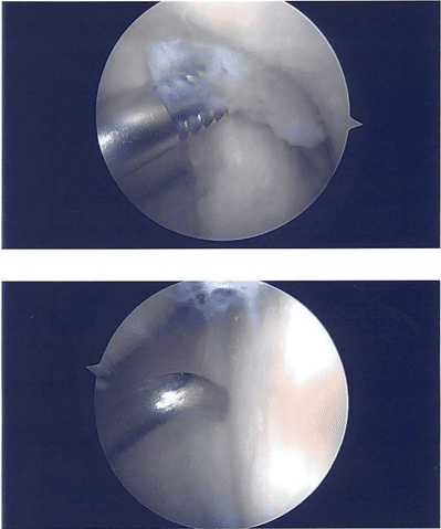 Imágenes intraoperatorias