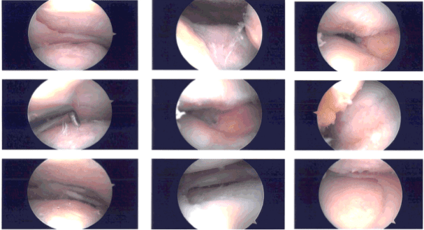 Imágenes intraoperatorias