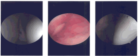 Intraoperative photo